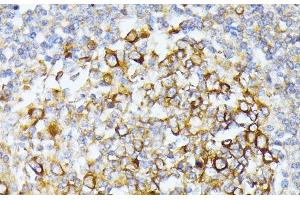 Immunohistochemistry (Paraffin-embedded Sections) (IHC (p)) image for anti-Carbamoyl-Phosphate Synthetase 2, Aspartate Transcarbamylase, and Dihydroorotase (CAD) antibody (ABIN7264367)