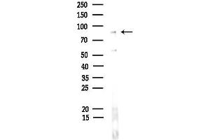Western blot analysis of lysates from Hela cells, using GLIS3 Antibody at 1/1000 dilution.