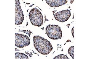 IHC analysis of SAP130 using anti-SAP130 antibody (ABIN7601247). (SAP130 antibody  (AA 309-913))