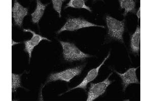 Immunofluorescent staining of HeLa (ATCC CCL-2) cells. (GRB2 antibody  (AA 1-217))