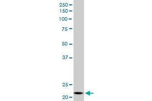 NDUFV2 monoclonal antibody (M03), clone 1A10. (NDUFV2 antibody  (AA 150-249))