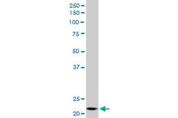 NDUFV2 antibody  (AA 150-249)
