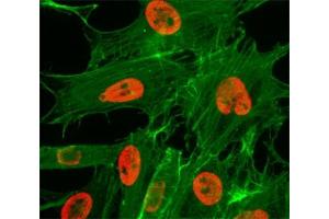 ICC/IF test of HeLa cells treated with sodium butyrate using recombinant H3K27ac antibody (red). (Recombinant Histone 3 antibody  (acLys27))