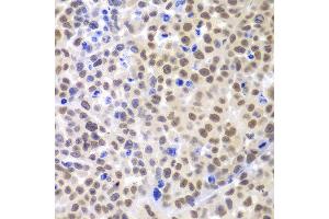 Immunohistochemistry of paraffin-embedded mouse cancer using LHX4 antibody at dilution of 1:100 (x400 lens). (LHX4 antibody)