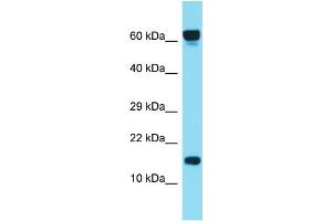 Host: Rabbit Target Name: C1orf86 Sample Type: ACHN Whole cell lysates Antibody Dilution: 1. (C1orf86 antibody  (C-Term))