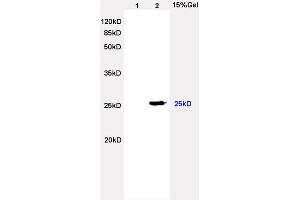 L2 rat heart lysates probed with Anti Lambda Light Chain Polyclonal Antibody, Unconjugated (ABIN704321) at 1:200 overnight at 4 °C. (Lambda-IgLC antibody  (AA 41-106))