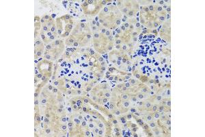 Immunohistochemistry of paraffin-embedded mouse kidney using HK3 antibody (ABIN5974682) at dilution of 1/100 (40x lens).