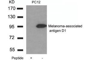 Western blot analysis of extracts from PC12 cells using Melanoma-associated antigen D1 Antibody and the same antibody preincubated with blocking peptide.