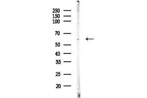 anti-Endonuclease Domain Containing 1 (ENDOD1) (Internal Region) antibody
