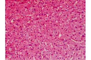 Human Liver: Formalin-Fixed, Paraffin-Embedded (FFPE) (Liver Arginase antibody  (AA 1-145))