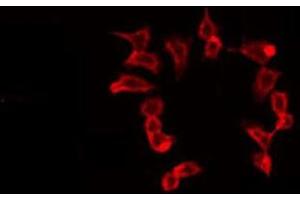 ABIN6275682 staining 293 by IF/ICC. (WASF2 antibody  (Internal Region))