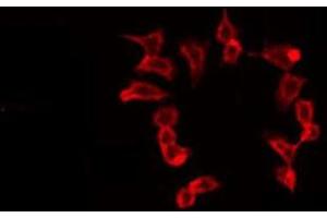 ABIN6275682 staining 293 by IF/ICC. (WASF2 antibody  (Internal Region))