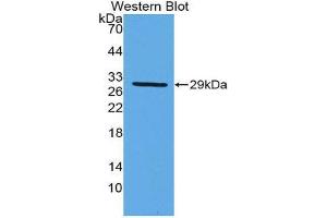 Western Blotting (WB) image for anti-Damage-Specific DNA Binding Protein 2, 48kDa (DDB2) (AA 166-383) antibody (ABIN1980395) (DDB2 antibody  (AA 166-383))