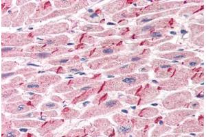 Human Heart (formalin-fixed, paraffin-embedded) stained with JUP antibody ABIN305904 at 5 ug/ml followed by biotinylated anti-goat IgG secondary antibody ABIN481715, alkaline phosphatase-streptavidin and chromogen. (JUP antibody  (AA 732-745))