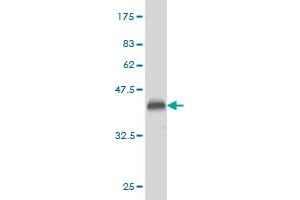 Western Blot detection against Immunogen (36. (Phospholipase D2 antibody  (AA 834-933))