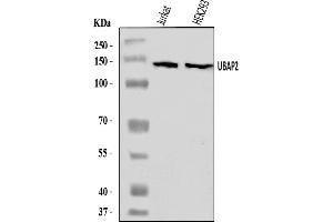 Western blot analysis of UBAP2 using anti-UBAP2 antibody (ABIN7602500).