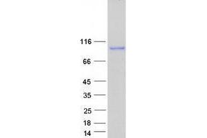 Validation with Western Blot (USO1 Protein (Myc-DYKDDDDK Tag))