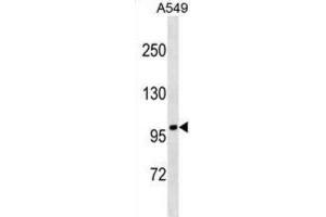 Western Blotting (WB) image for anti-Fanconi Anemia, Complementation Group B (FANCB) antibody (ABIN2999895) (FANCB antibody)