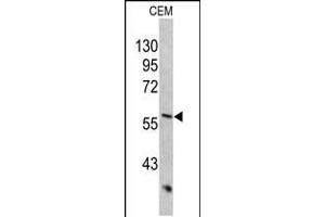 Western blot analysis of KRT10 antibody in CEM cell line lysates (35ug/lane) (Keratin 10 antibody  (AA 318-346))