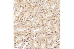 Immunohistochemistry (Paraffin-embedded Sections) (IHC (p)) image for anti-Ubiquitin Protein Ligase E3A (ube3a) antibody (ABIN7076105)
