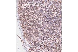 Immunohistochemical analysis of (ABIN657900 and ABIN2846851) on paraffin-embedded Human lymph node tissue.