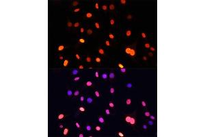 Immunofluorescence analysis of C6 cells using Pan DiMethyl-lysine antibody (ABIN7266777) at dilution of 1:100. (Dimethyl-Lysine antibody)
