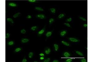 Immunofluorescence of monoclonal antibody to EIF4EBP1 on HeLa cell.