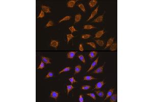 Immunofluorescence analysis of L929 cells using Kininogen 1 (Kininogen 1 (KNG1)) Rabbit pAb (ABIN3022363, ABIN3022364, ABIN3022365 and ABIN6218762) at dilution of 1:100 (40x lens). (KNG1 antibody  (AA 148-427))