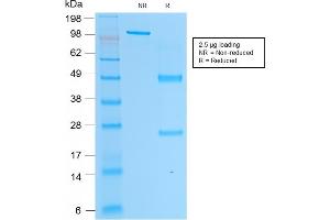 SDS-PAGE Analysis Purified PSAP Mouse Monoclonal Antibody (rACPP/1338). (Recombinant ACPP antibody)