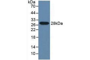 WB of Protein Standard: different control antibodies against Highly purified E. (CYP2E1 ELISA Kit)