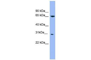 WB Suggested Anti-NDUFS3 Antibody Titration: 0. (NDUFS3 antibody  (Middle Region))