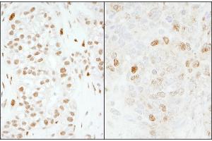 Immunohistochemistry (IHC) image for anti-Forkhead Box K1 (Foxk1) (AA 683-733) antibody (ABIN7454776)