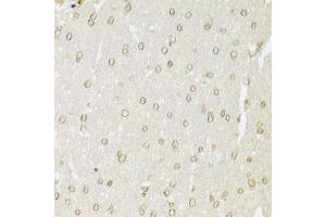 Immunohistochemistry (Paraffin-embedded Sections) (IHC (p)) image for anti-X-Ray Repair Complementing Defective Repair in Chinese Hamster Cells 6 (XRCC6) (AA 500-600) antibody (ABIN1513143)