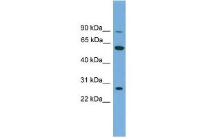 WB Suggested Anti-IMPDH2 Antibody Titration: 0. (IMPDH2 antibody  (N-Term))