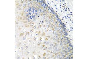 Immunohistochemistry of paraffin-embedded human esophagus using STXBP4 antibody at dilution of 1:100 (40x lens). (STXBP4 antibody)