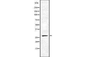 Western blot analysis OR10X1 using COLO205 whole cell lysates (OR10X1 antibody  (Internal Region))