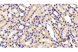 Detection of CHEM in Rat Kidney Tissue using Polyclonal Antibody to Chemerin (CHEM) (Chemerin antibody  (AA 25-152))