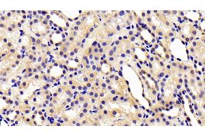 Detection of CHEM in Rat Kidney Tissue using Polyclonal Antibody to Chemerin (CHEM)