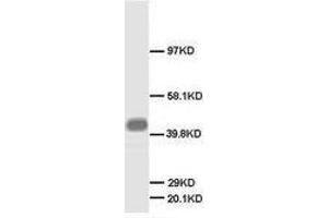 Image no. 2 for anti-Growth Associated Protein 43 (GAP43) (N-Term) antibody (ABIN1495047) (GAP43 antibody  (N-Term))