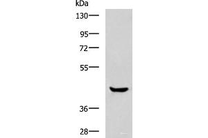 Western blot analysis of Human muscle tissue lysate using HOXA2 Polyclonal Antibody at dilution of 1:800 (HOXA2 antibody)