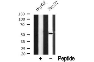 Western blot analysis of NDR1/2 in lysates of HepG2? (NDR1/2 antibody)