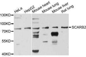 Western blot analysis of extracts of various cell lines, using SCARB2 antibody. (SCARB2 antibody)