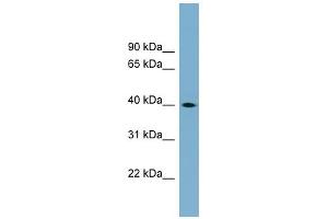 WB Suggested Anti-TSPAN17 Antibody Titration:  0. (Tetraspanin 17 antibody  (Middle Region))