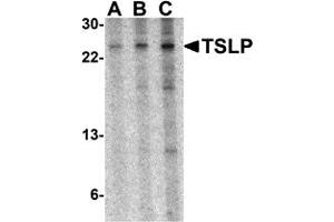 Western Blotting (WB) image for anti-Thymic Stromal Lymphopoietin (TSLP) (Middle Region) antibody (ABIN1031148)