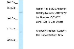 Western Blotting (WB) image for anti-Smg-9 Homolog, Nonsense Mediated mRNA Decay Factor (SMG9) (N-Term) antibody (ABIN971735) (SMG9 antibody  (N-Term))