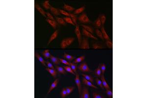 Immunofluorescence analysis of NIH-3T3 cells using CDC42 Rabbit pAb (ABIN3021670, ABIN3021671, ABIN3021672 and ABIN6215499) at dilution of 1:50 (40x lens).
