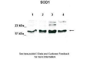 Lanes:   Lane 1: 50ug HeLa lysate Lane 2: 50ug 293T lysate Lane 3: 50ug K562 lysate Lane 4: 50ug MDA-MB-231 lysate  Primary Antibody Dilution:   1:500  Secondary Antibody:   Anti-rabbit-HRP  Secondary Antibody Dilution:   1:1000  Gene Name:   SOD1  Submitted by:   David Colecchia, Ph. (SOD1 antibody  (N-Term))