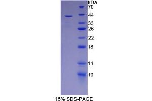 Image no. 1 for Paraoxonase 2 (PON2) (AA 1-354) protein (His tag) (ABIN6236962) (PON2 Protein (AA 1-354) (His tag))