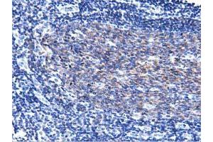 Immunohistochemical staining of paraffin-embedded Human lymph node tissue using anti-PIK3AP1 mouse monoclonal antibody. (PIK3AP1 antibody)