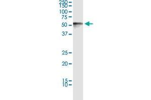 Immunoprecipitation (IP) image for PTRF (Human) IP-WB Antibody Pair (ABIN2752032)